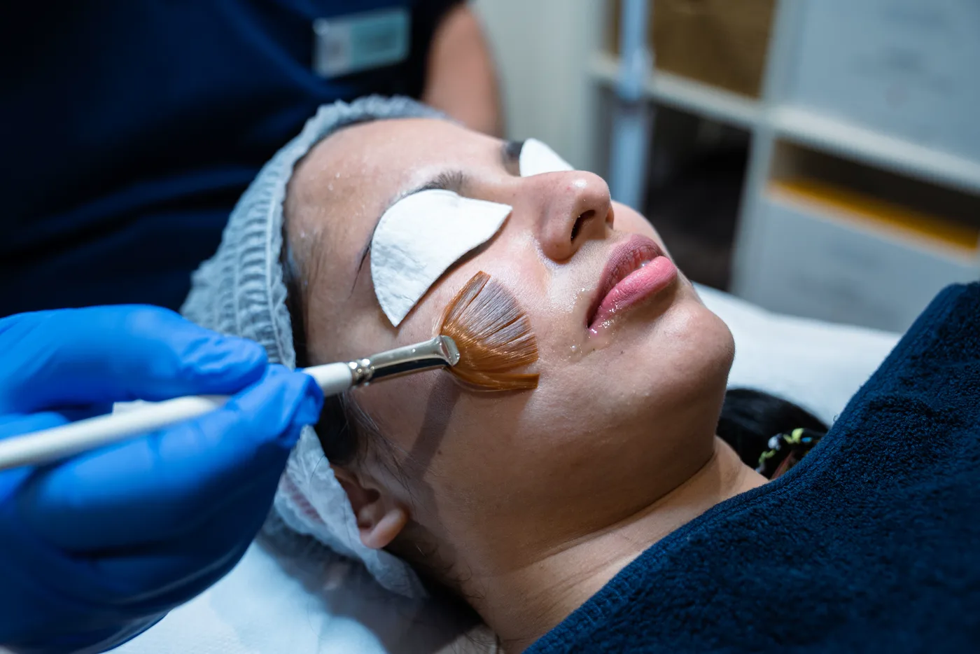 SE1 Signature Peel treatment