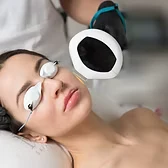 Lumecca IPL treatment